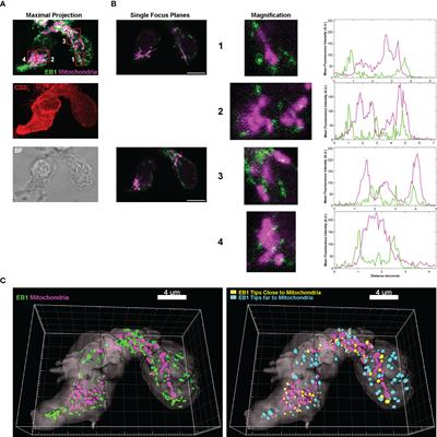 End-binding protein 1 regulates the metabolic fate of CD4+ T lymphoblasts and Jurkat T cells and the organization of the mitochondrial network